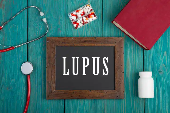 Lupus pediatrico